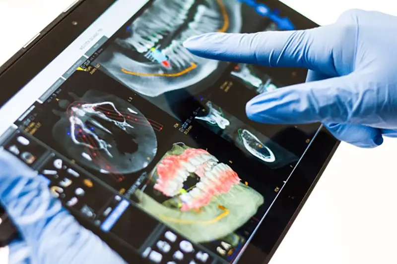 Person holding black iPad with dental images