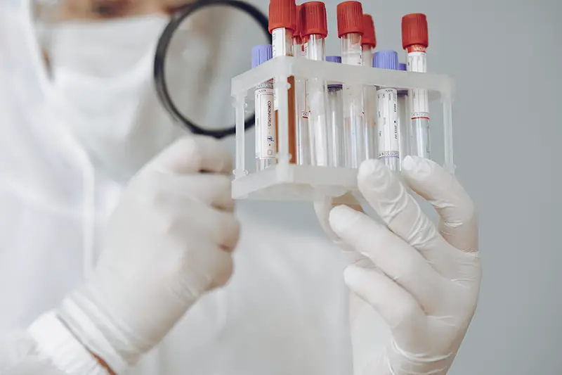 Person holding test tube rack